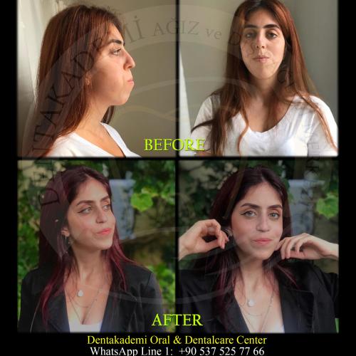 Before after photos of our patients 1